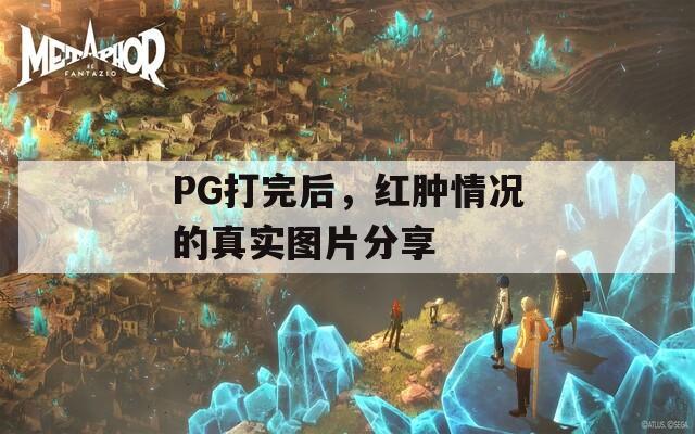 PG打完后，紅腫情況的真實圖片分享